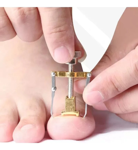 3pz Herramienta Para Sacar Uñas Enterradas Removedor Uñeros