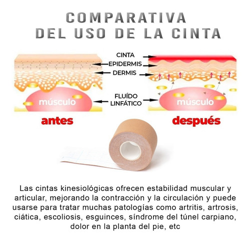 Imagen 3 de 7 de Cinta Kinesiologica Tape Kinesio Color Piel