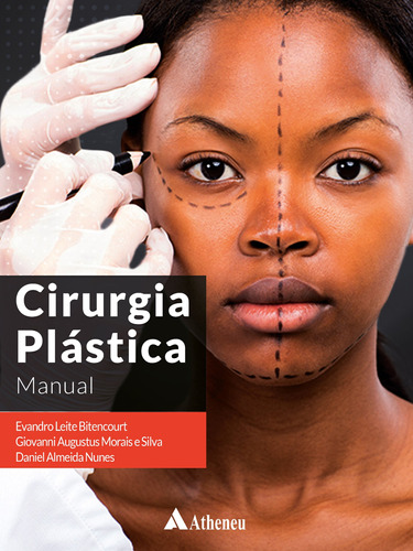 Cirurgia Plástica Manual, de Bitencourt, Evandro Leite. Editora Atheneu Ltda, capa dura em português, 2021