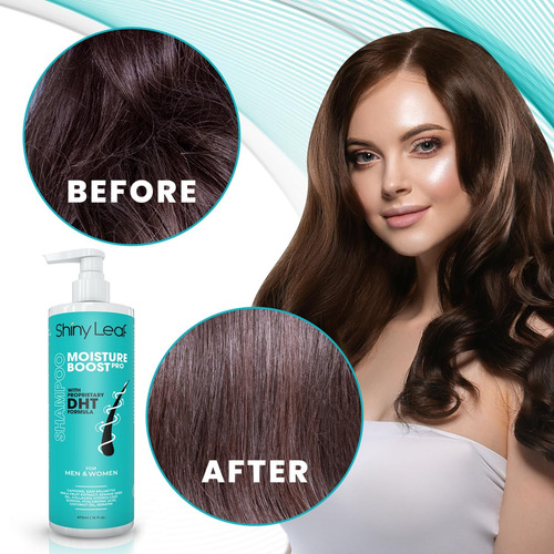 Shampoo De Crescimento Natural Do Cabelo - Bloqueador De Dht