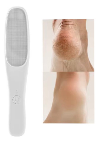 Quita Callos Exfoliador Electrico Para Pies Lima Removedora