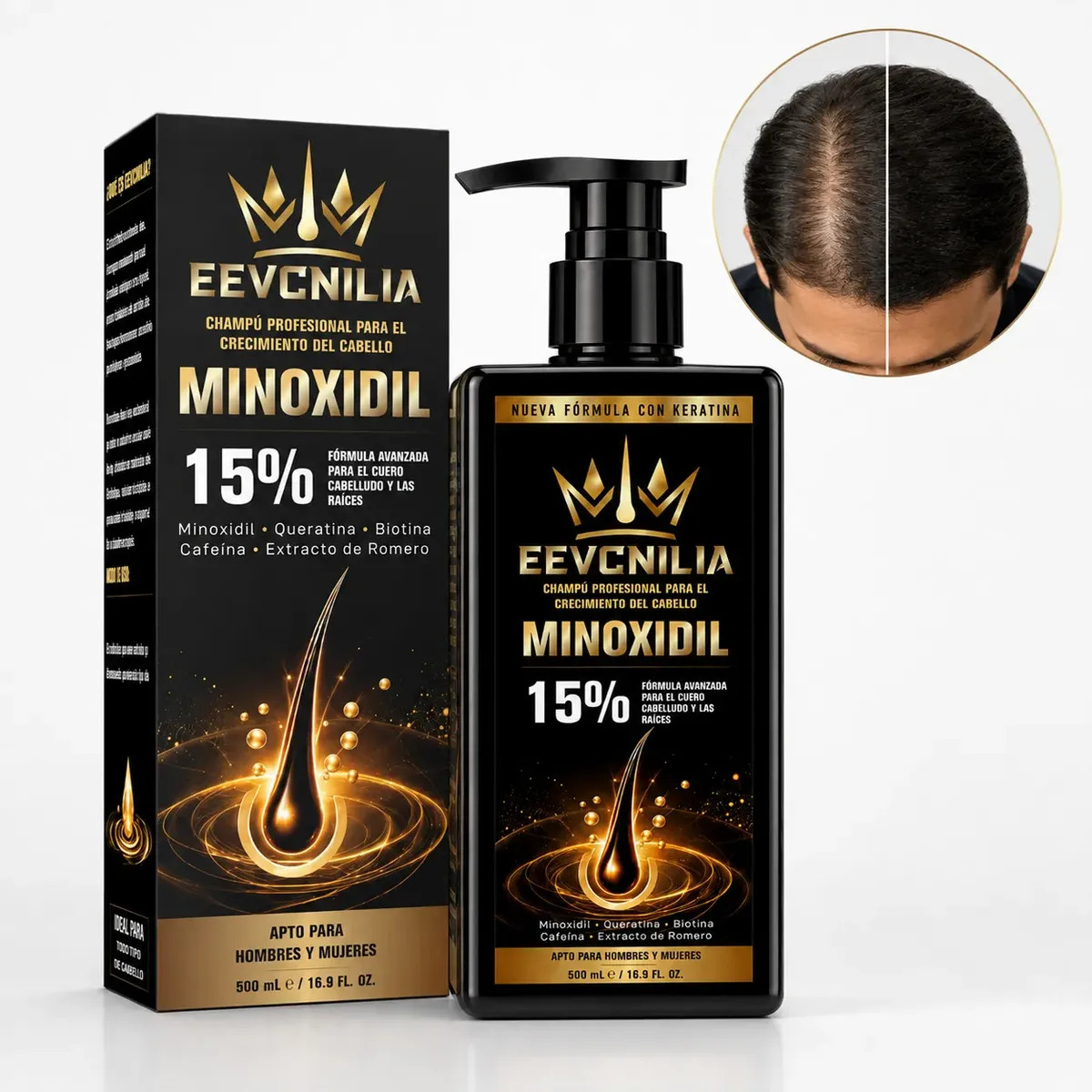 Champú Minoxidil 15% Crecimiento Capilar, Queratina Biotina Cafeína, Fortalece Raíces, Reduce Caída Cabello Para Hombre Y Mujer 500ml