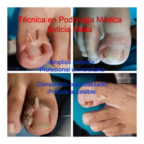 Imagen 8 de 8 de Podologa