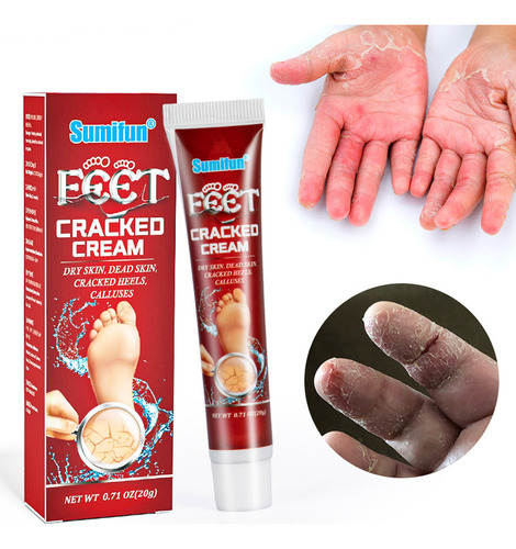 Crema Antiagrietamiento Seca Con Crema Agrietante