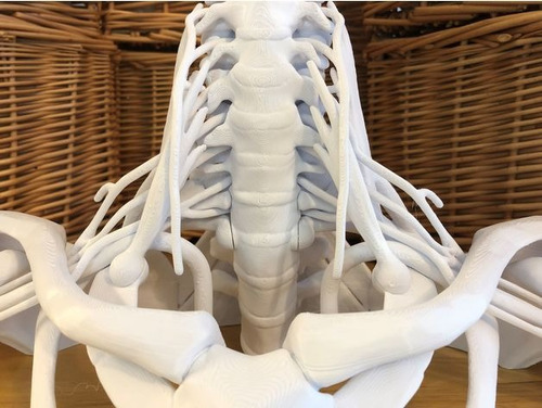 Modelo Anatomico Educativo Plexo Braquial Impreso En 3d