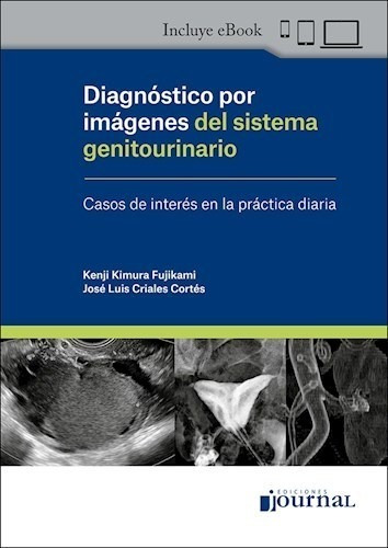Diagnóstico Por Imágenes Del Sistema Genitourinario - Kimura