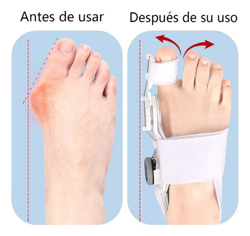 Enderezador De Dedos - Corrector Ortopédico De Juanetes