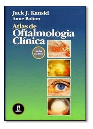 Atlas De Oftalmologia Clinica, De Jack J. Kanski. Editora Artmed Em Português