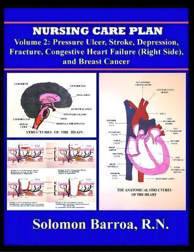 Nursing Care Plan, De Solomon Barroa Rn. Editorial Createspace Independent Publishing Platform, Tapa Blanda En Inglés