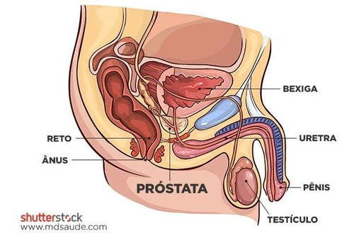 Prostatitis gonorrhoica chronica