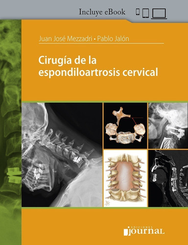 Mezzadri Jalon Cirugía De La Espondiloartrosis Cervical