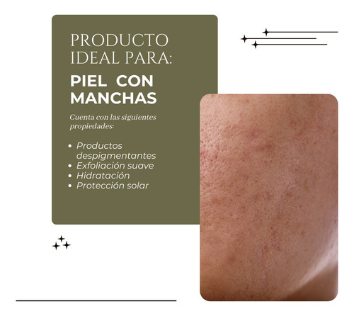 Crema Blanqueadora Despigmentante By Michelle Organic