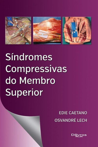 Sindromes Compressivas Do Membro Superior, De Edie Caetano. Editora Dilivros, Capa Dura Em Português, 2016