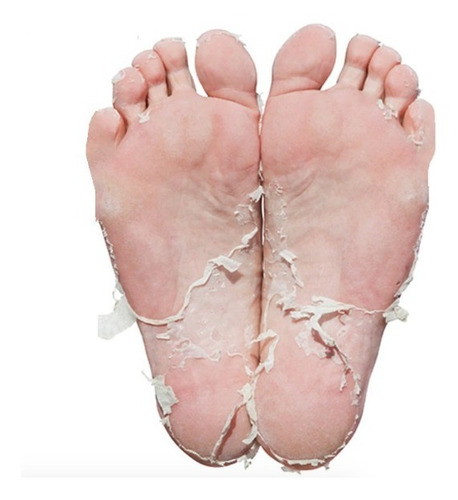 Imagen 5 de 8 de 10 Mascarilla Exfoliante Para Pies Remueve Durezas Callos