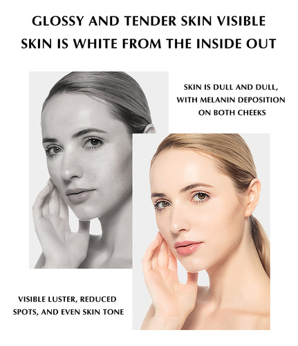 Creme Clareador Para Remoção De Sardas, Hidratante, Reparado