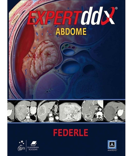 Expertddx - Abdome - Federle, De Federle. Editora Guanabara, Capa Dura Em Português, 2010