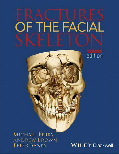 Fractures Of The Facial Skeleton, De Michael Perry. Editorial John Wiley And Sons Ltd, Tapa Blanda En Inglés