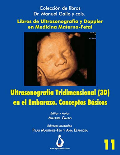 Ultrasonografia Tridimensional En El Embarazo (3d). Concepto