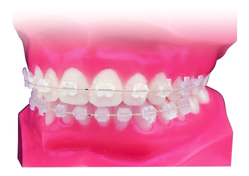 Brackets Ceramicos Orthoorganizer Usax20 Completo Roth/mbt