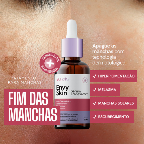 Sérum Facial Melasma E Acne Com Ácido Tranexâmico Acneica Noite