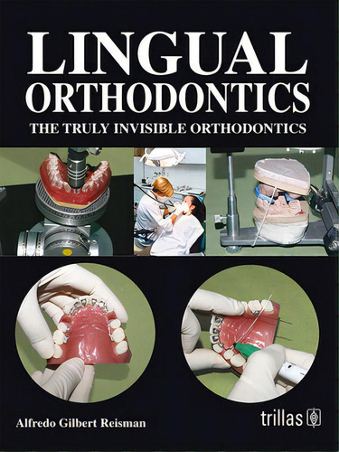 Lingual Orthodontics: The Truly Invisible Orthodontics: The Truly Invisible Orthodontic, De Gilbert Reisman Alfredo. Editorial Trillas, Tapa Blanda, Edición 1 En Español, 2008