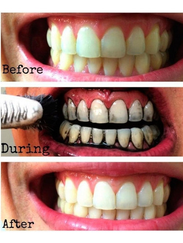 Blanqueador Dental Miracle Teeth Carbon Coco Natural No Daña