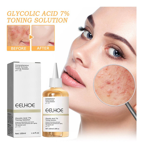 Exfoliante Facial Con Ácido Glicólico Al 7%, Astringe Los Po