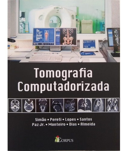 Tomografia Computadorizada