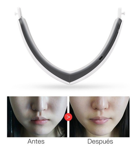 Maquina Facial Ems Vibración Alta Frecuencia Quitar Papada