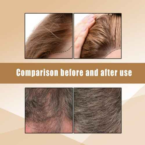 7 Barras De Xampu De Gengibre Para O Crescimento Do Cabelo