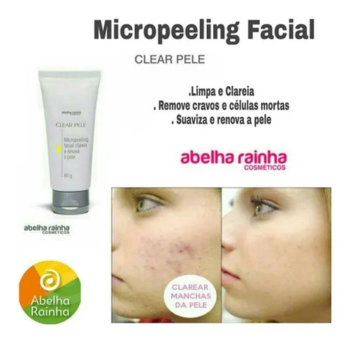 Micropeeling Facial Clareia E Renova A Pele Abelha Rainha Tipo De Pele Mista