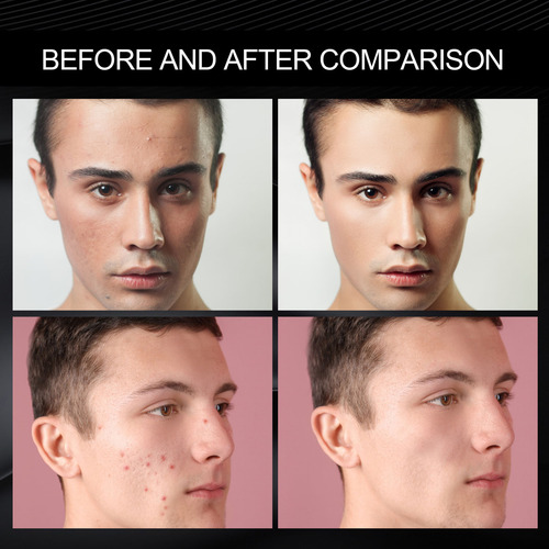 Crema Lisa Para Hombre V, Corrector, Marcas Y Defectos Cután