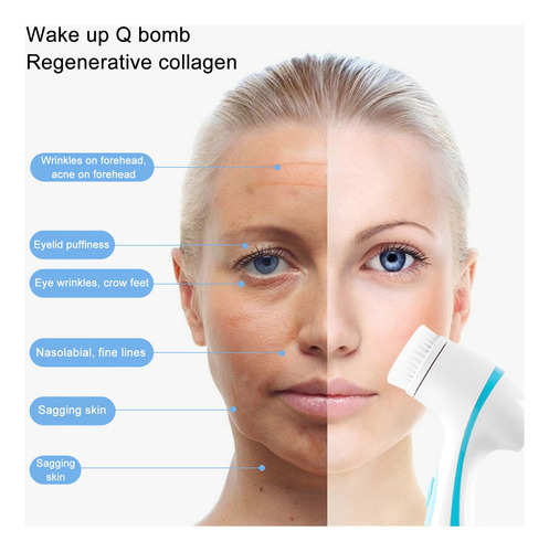 Cepillo Facial Eléctrico, Cepillo Limpiador Facial