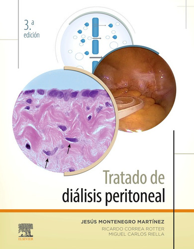Tratado De Diálisis Peritoneal (3ª Ed.) - Montenegro Martíne