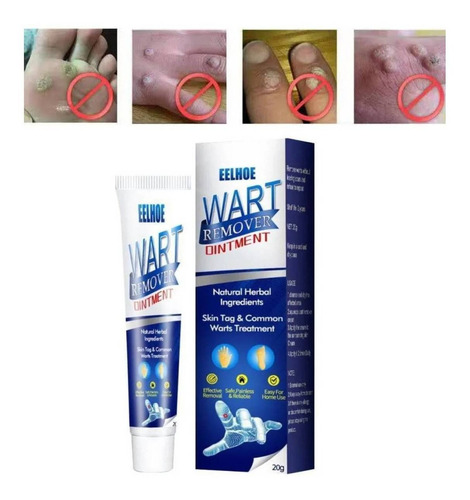 Pomada, Creme, Removedor De Verrugas, Manchas