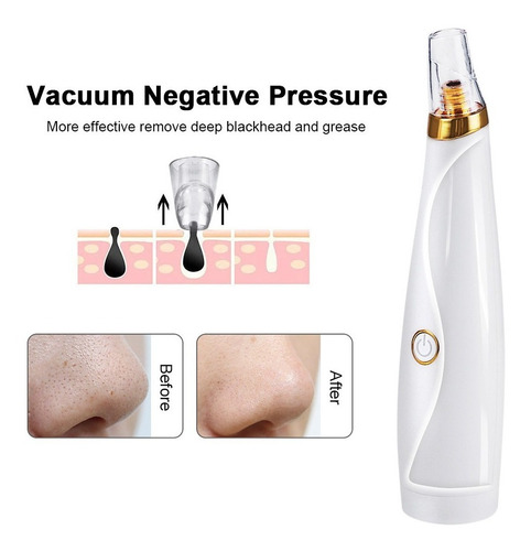 Blackhead Remover Pore Vacuum Pimple Extractor With Curved