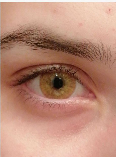 Eyeshare® Pupilentes Estonia Brown Duración 1 Año + Estuche
