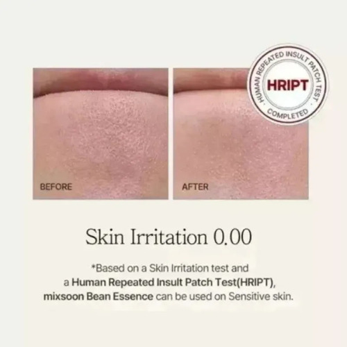 Nuevo Producto Exfoliante Facial Fb Essence Mixsoon Essence