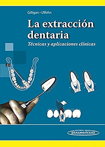 Libro La Extracción Dentaria De Jorge Marcelo Gilligan Adriá