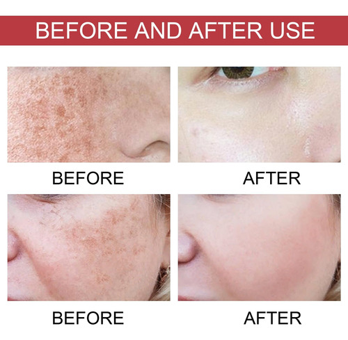 Suero Corrector De Manchas Oscuras Con Niacinamida
