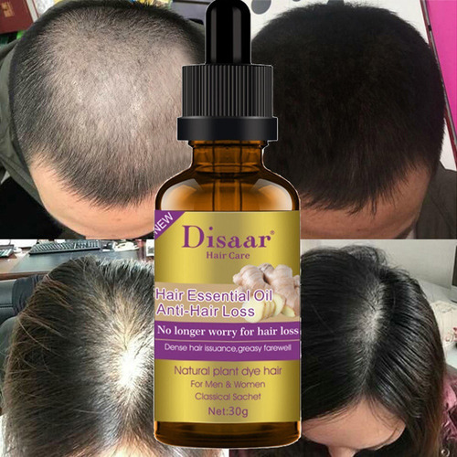 Aceite Crecimiento Del Cabello 30ml Alopecia Calvicie Disaar