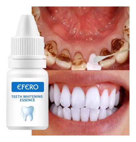 Esencia Blanqueadora De Dientes, Higiene Y Limpieza Bucal, 5