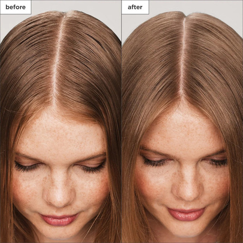 Tratamiento Para Cuero Cabelludo Scalp Revival Briogeo