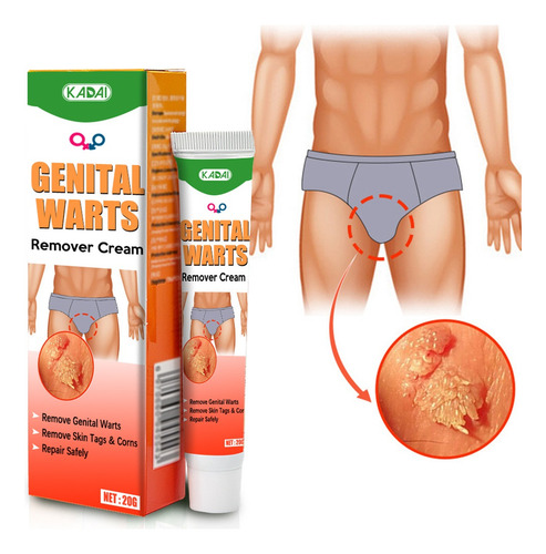 Ungüento Para Verrugas Con Ácido Salicílico,pacote Com 2 /