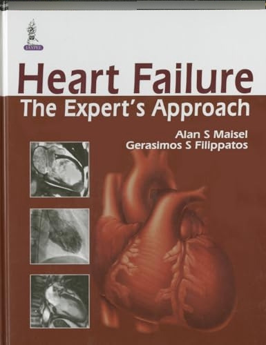 Libro Heart Failure De Alan S. Maisel, Gerasimos S. Filippat