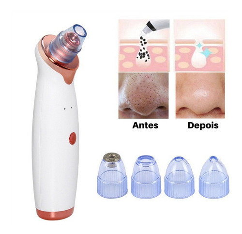 Removedor De Cravos Acne Elétrico Sucção Usb Peeling