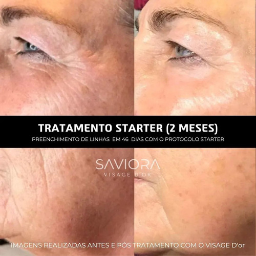 Visage Dor Sérum Clareador E Rejuvenescedor - Entrega Rápida Todo Tipo De Pele Noite