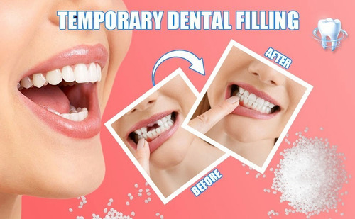 Eelhoe Dientes Postizos Dientes Reparación Gránulos 30ml