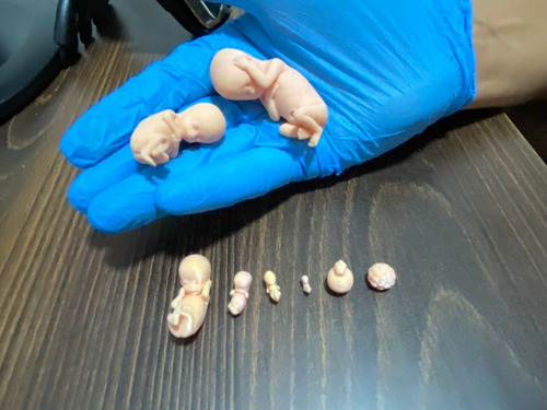 Feto Anatomia De 4 A 12 E 16 Resina E 22 Semanas Com Base