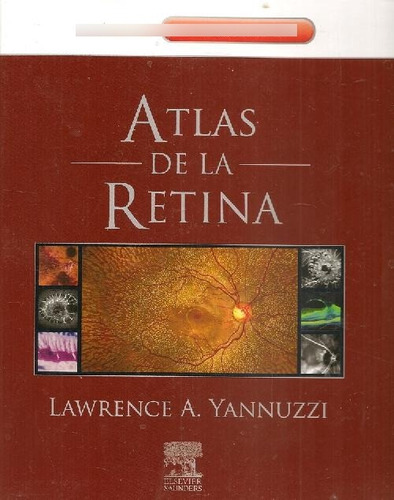 Libro Atlas De La Retina De Lawrence A Yannuzzi